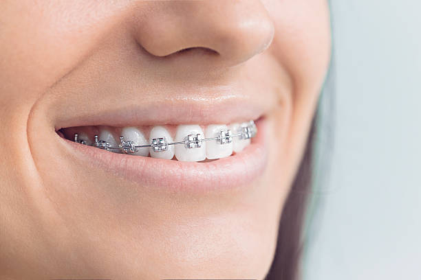 Best Invisalign and Clear Aligners  in Sands Point, NY